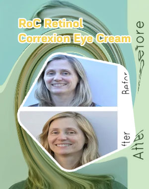 Roc eye cream before and after